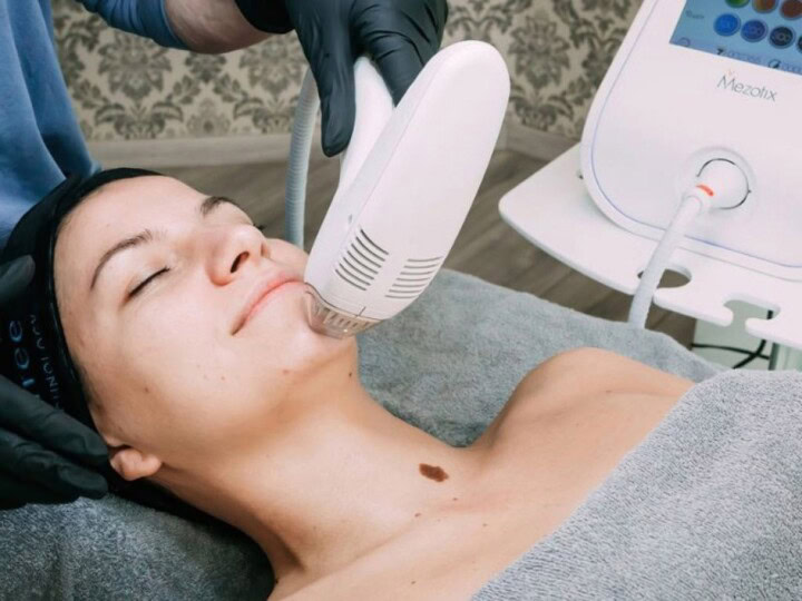 Hautbehandlung mit Mesotherapie bei einer Frau im Kosmetikstudio.